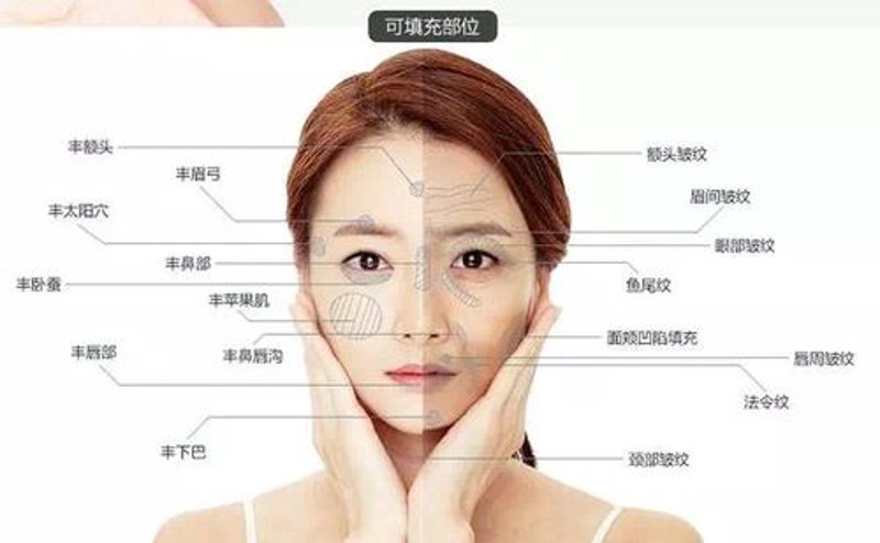 瘦身魔力：吸脂瘦身医院的发展与趋势