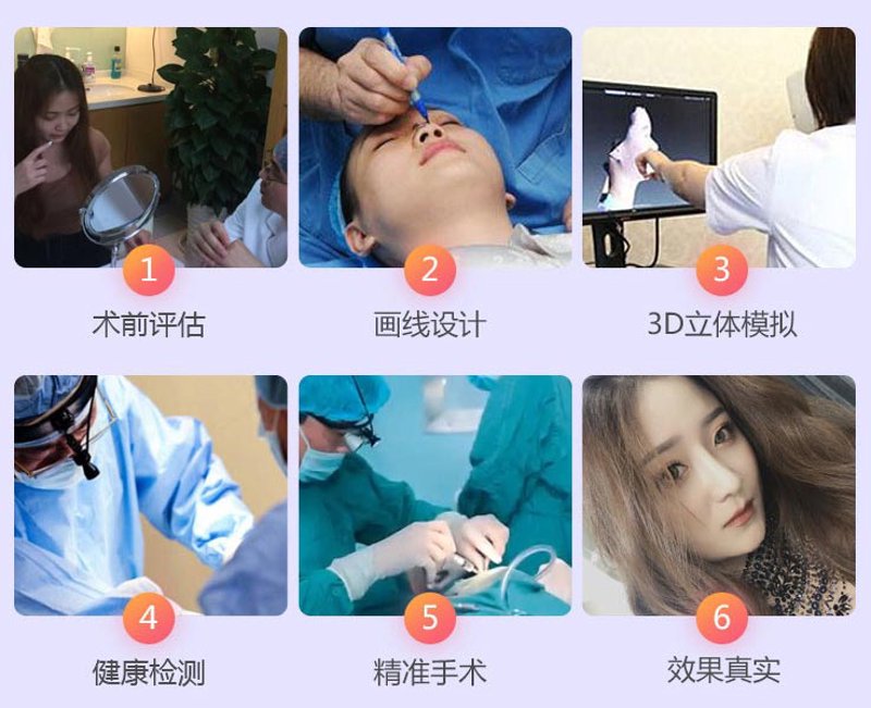 隆鼻整形医院