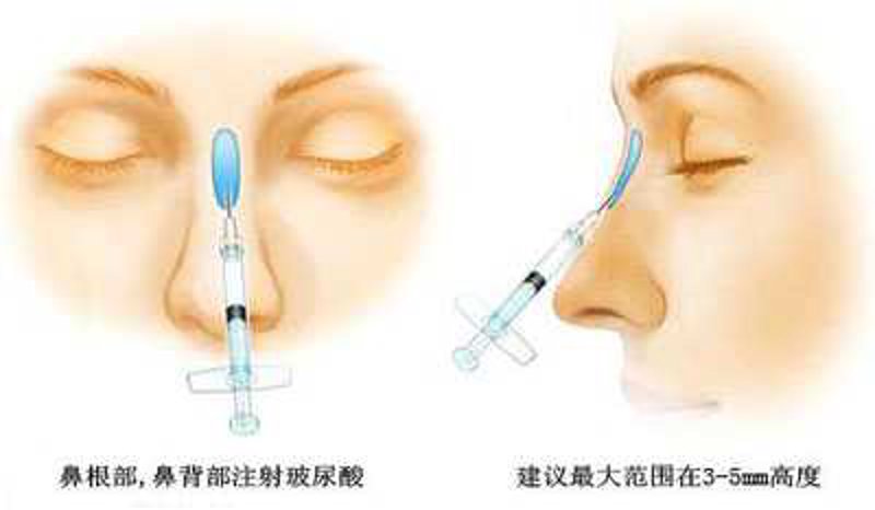 探寻郑州整形医院哪家更合适